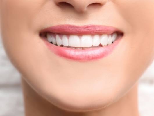 Close up of smile with straight white teeth