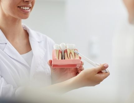 Dentist pointing to model of dental implant