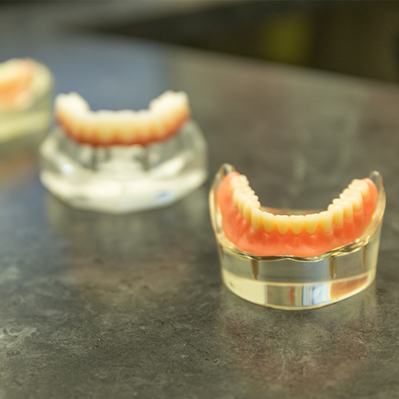 Two dentures in Denton on models of the mouth