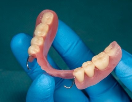 Gloved hand holding a partial denture