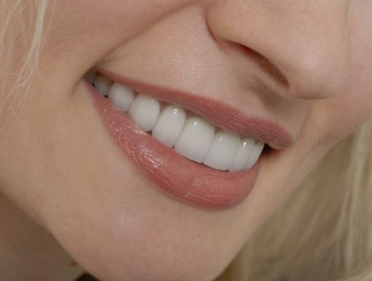 Close up of woman smiling with straight white teeth