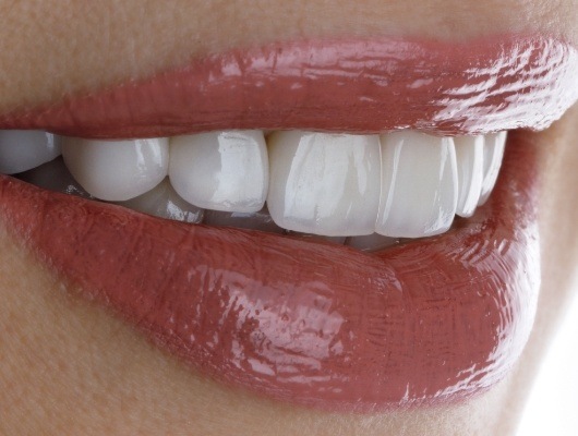 Close up of smile with straight white teeth