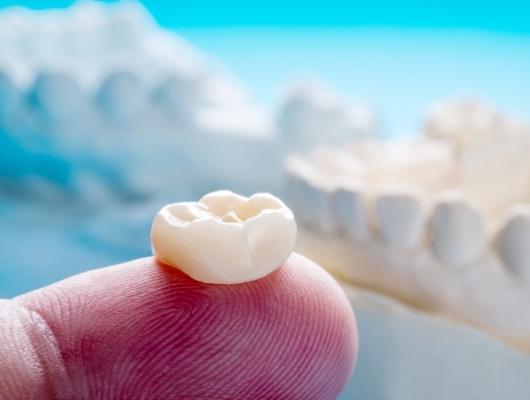 Person holding a dental crown on their finger